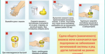 Как правильно сдавать мочу при беременности