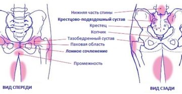 Боль в области таза сзади у женщин