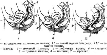 Матка отклонена кпереди