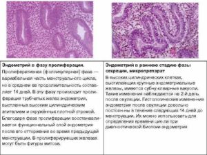 Эндометрий пролиферативного типа что это такое