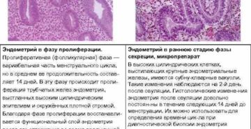 Эндометрий пролиферативного типа что это такое