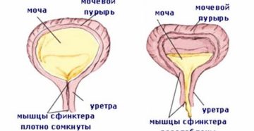 Слабый мочевой пузырь у женщин лечение