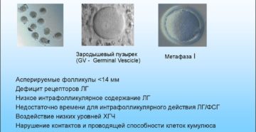 Как повысить качество яйцеклеток