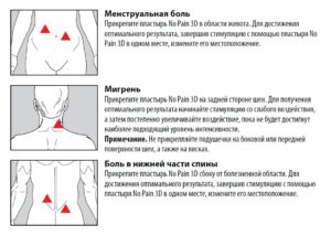 Боли в пояснице перед месячными