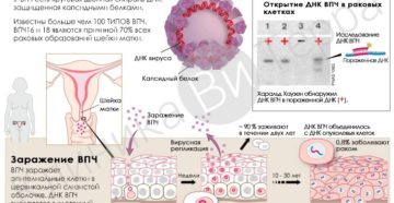 Hpv инфекция у женщин что это