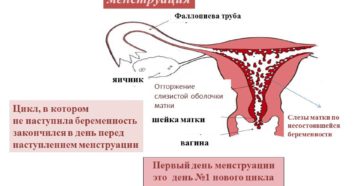 Если вообще нет месячных можно ли забеременеть