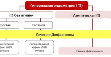 Лечение гиперплазии эндометрия дюфастоном