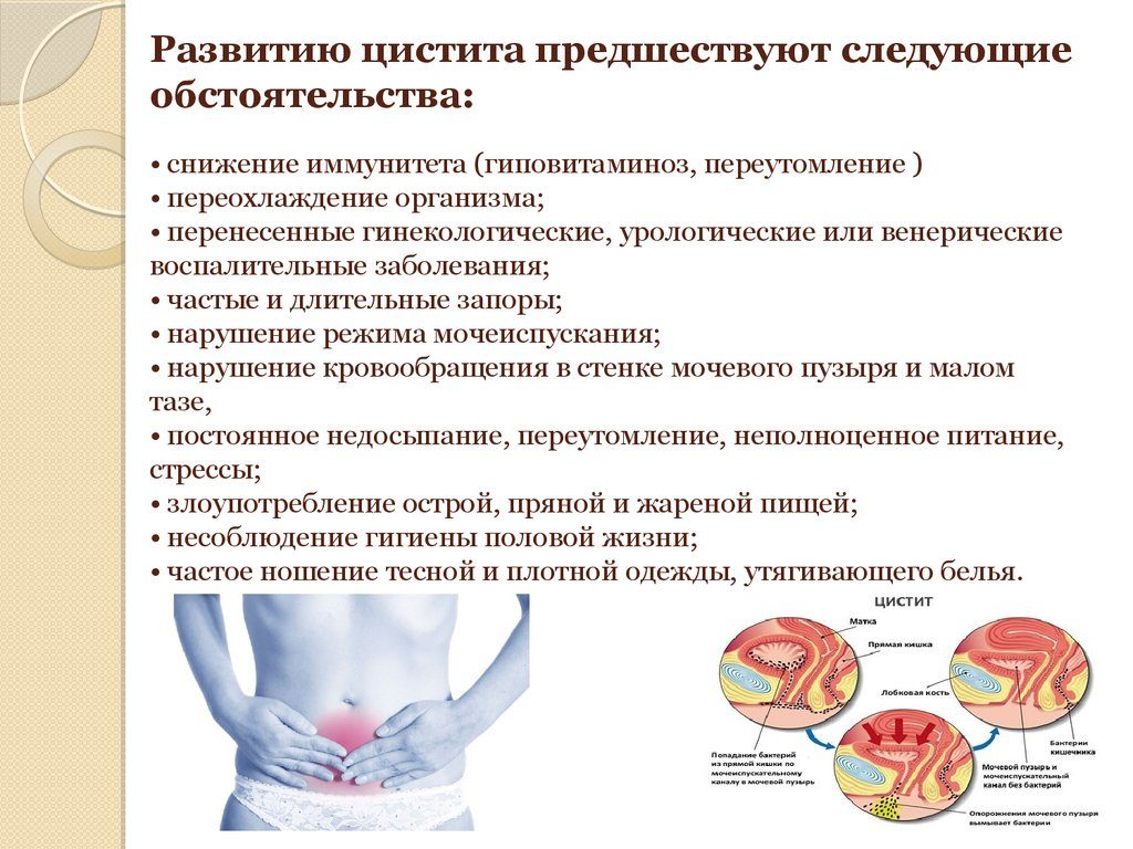 Какие инфекции вызывают цистит у женщин