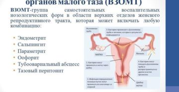 Симптомы воспаления органов малого таза у женщин