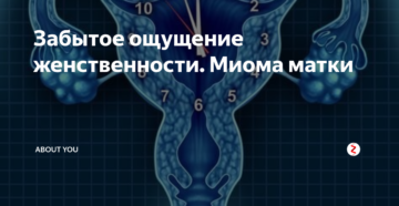 Психосоматика миома матки