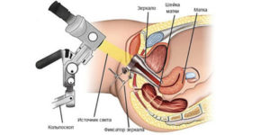 Почему кровит шейка матки при осмотре