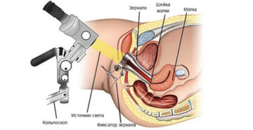 Почему кровит шейка матки при осмотре