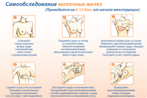 Выделение из грудных желез перед месячными